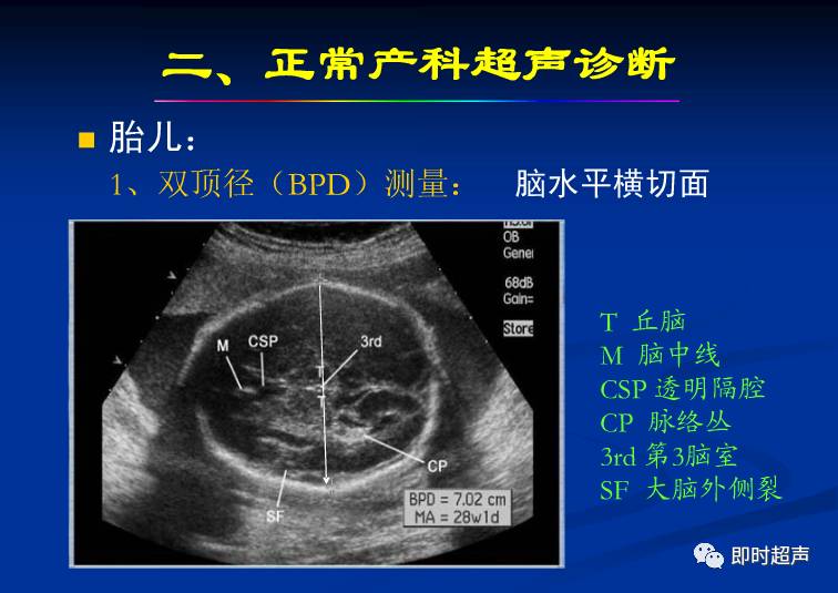 产前超声检查：胎儿正常超声表现及各项正常值解读