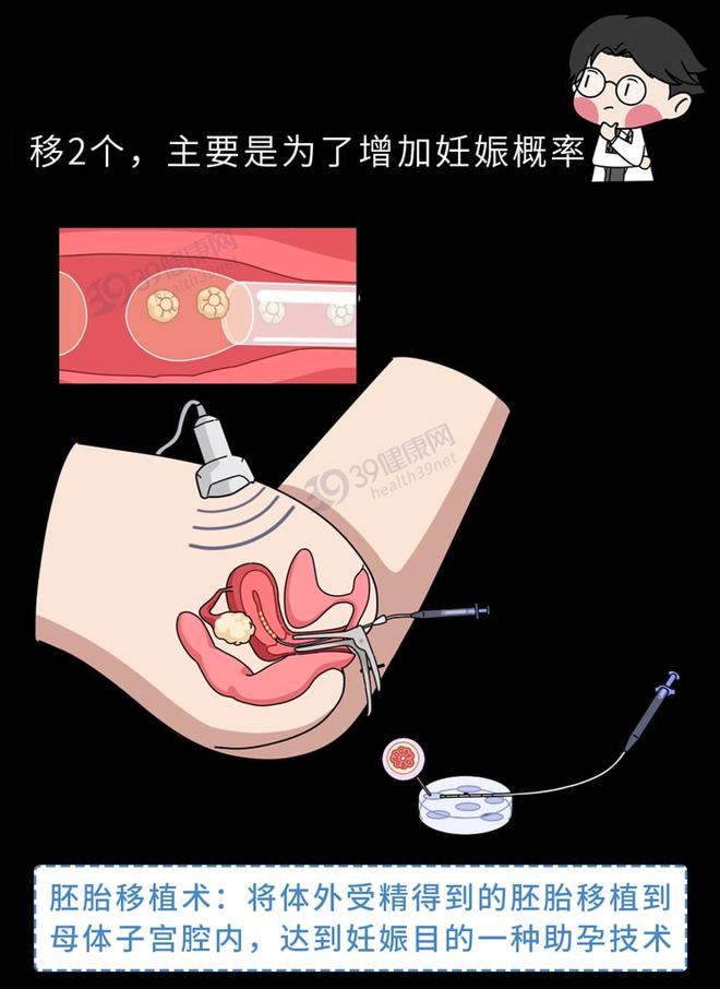 俄罗斯试管婴儿费用全解析：初步检查与取卵费用一览